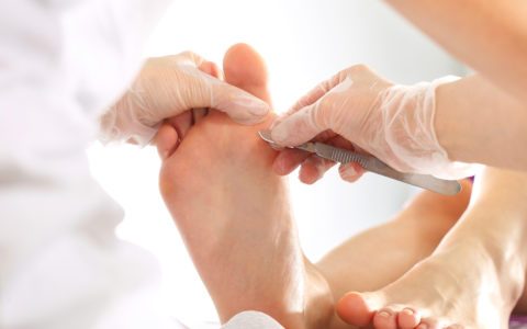 Rodzaje chorób dermatologicznych skóry stóp i paznokci – cz.2