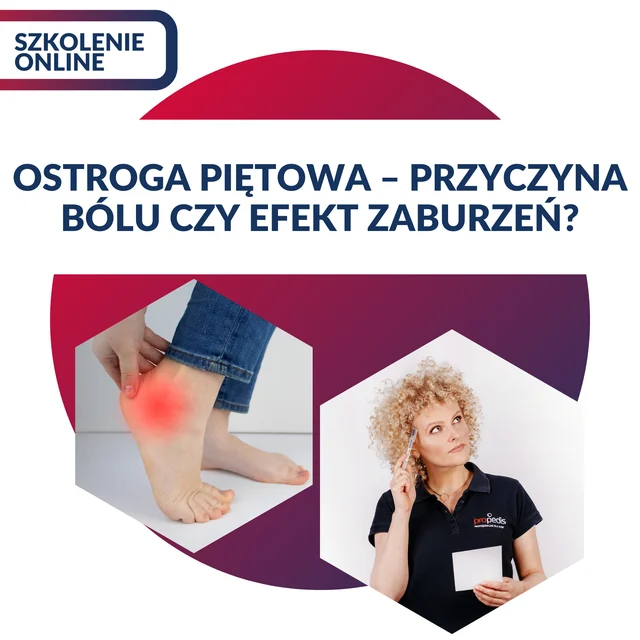 Okładka nagrania: Ostroga piętowa — przyczyna bólu czy efekt zaburzeń?
