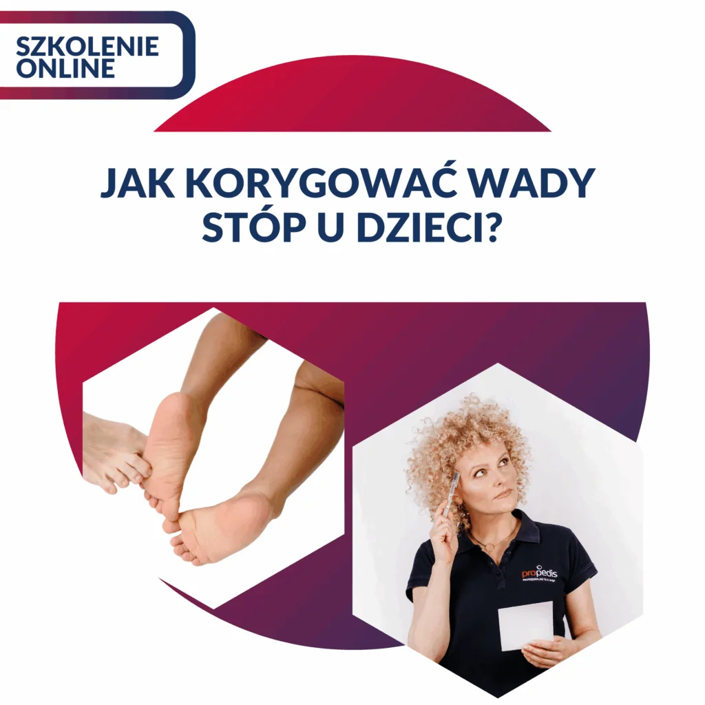 JAK KORYGOWAĆ WADY STÓP U DZIECI