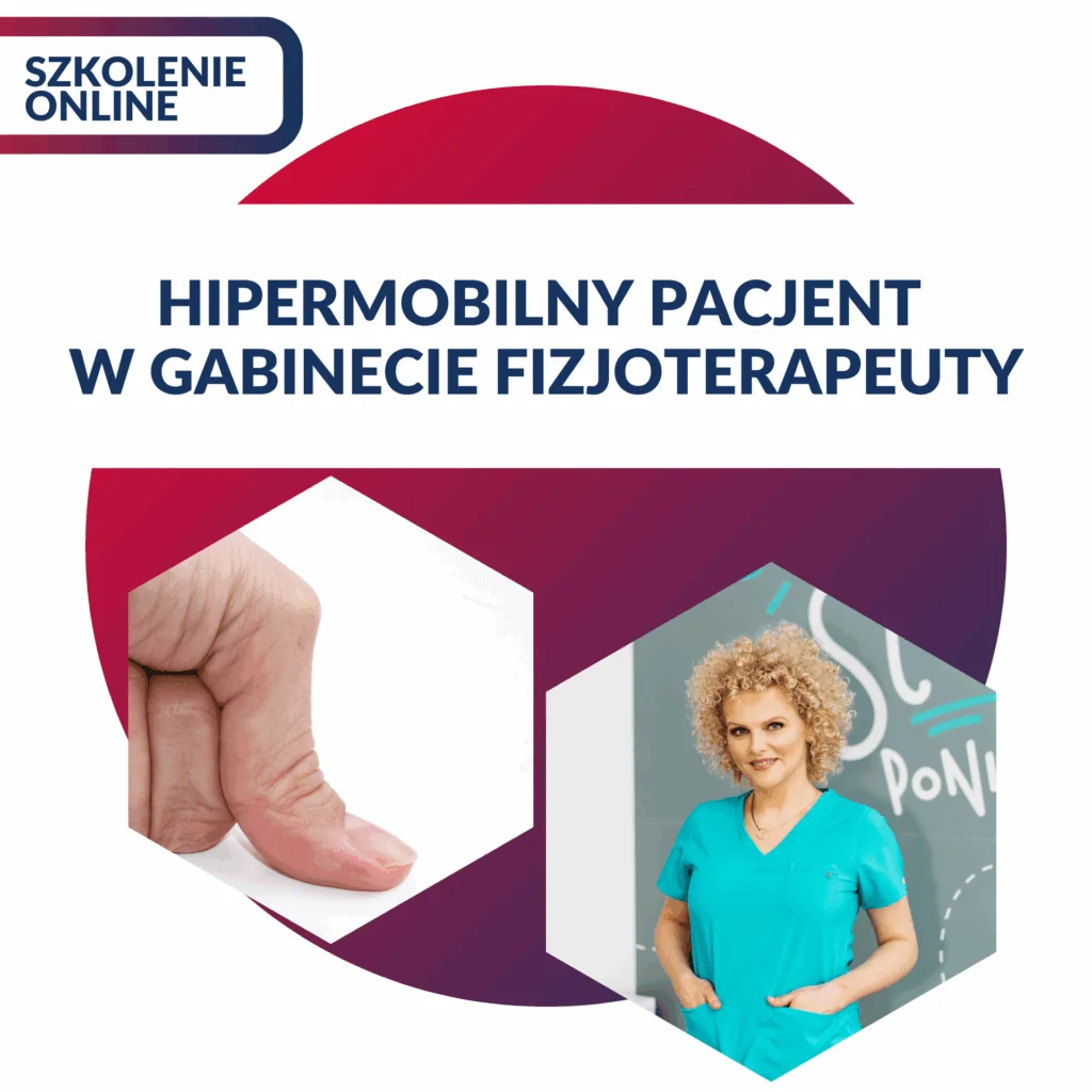 HIPERMOBILNY PACJENT W GABINECIE FIZJOTERAPEUTY