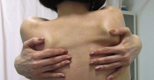 Jak rozpoznać hipermobilność? Metody diagnostyczne.