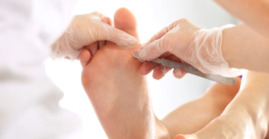 Rodzaje chorób dermatologicznych skóry stóp i paznokci – cz.2